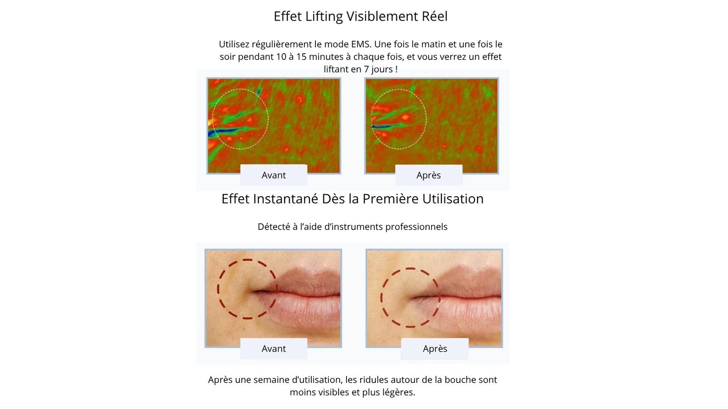 Thermolift Pen - Appareil radiofréquence visage