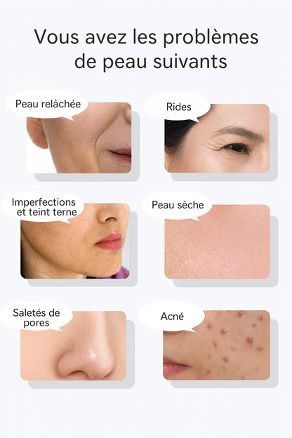 Thermolift Pen - Appareil radiofréquence visage